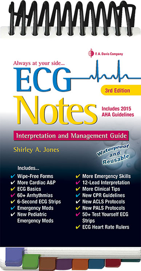 Ecg Notes Interpretation And Management Guide
